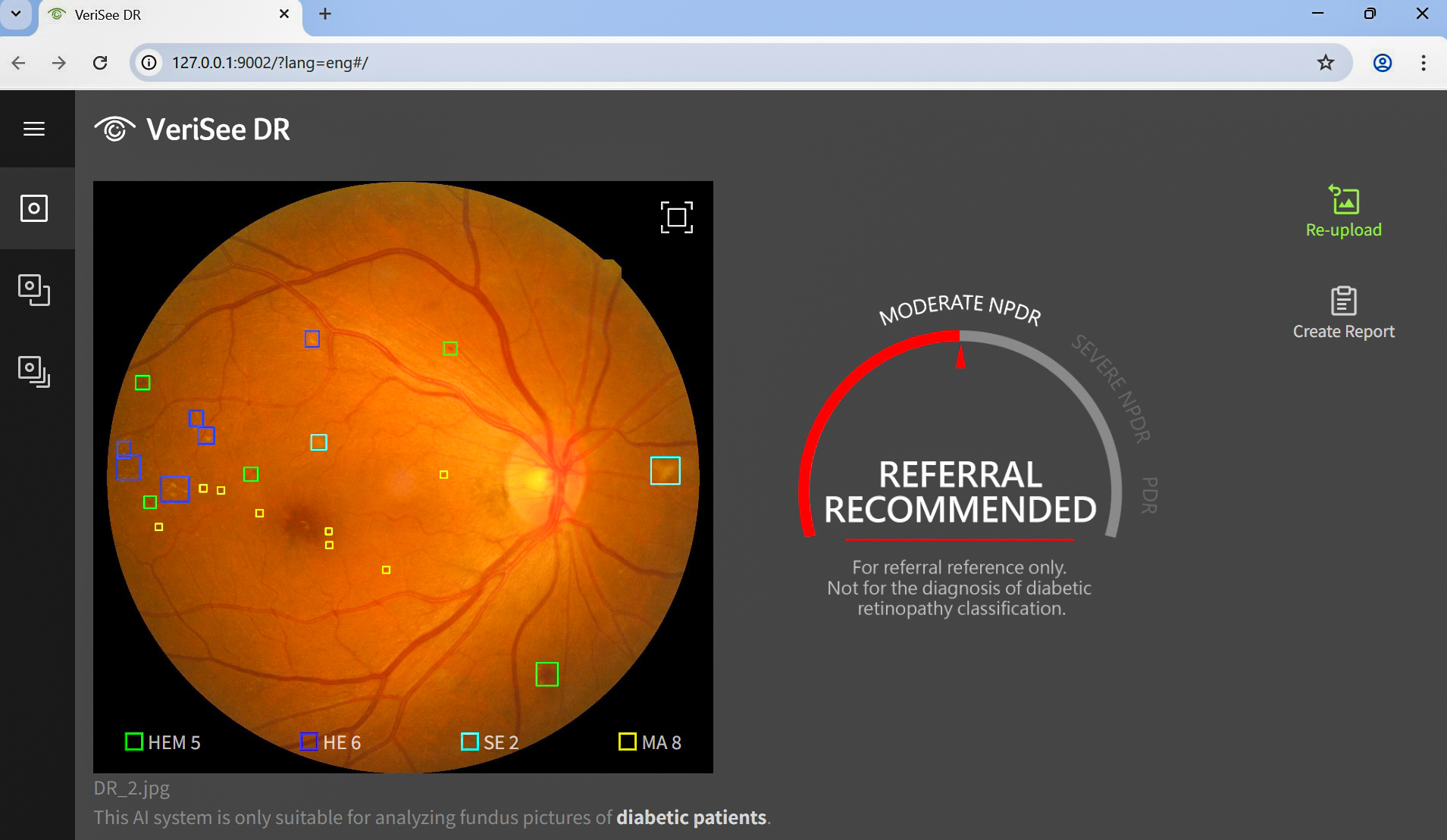 Intel Acer Medical 5
